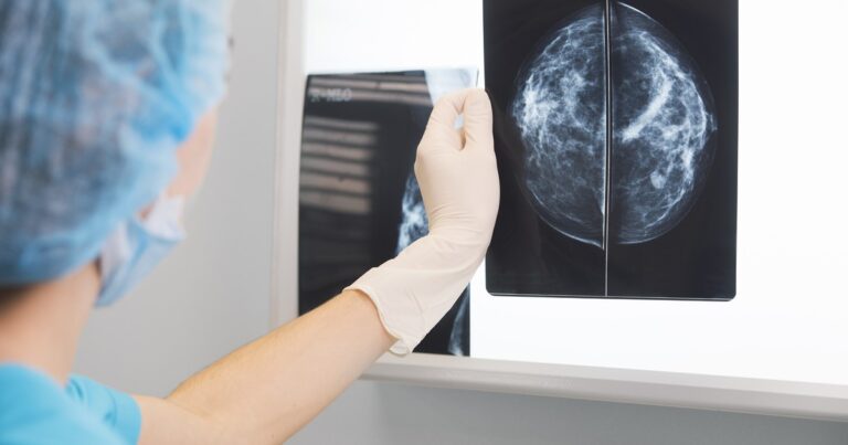 Cuánto cuestan y cómo se usan los tests genéticos que permiten detectar el riesgo de tener cáncer