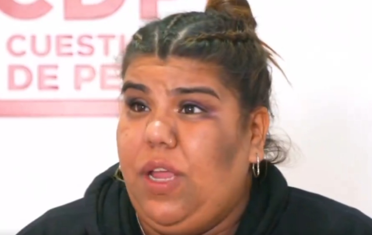 Camilota admitió todo lo que se hizo para transformar su cuerpo: «Me toqué los»