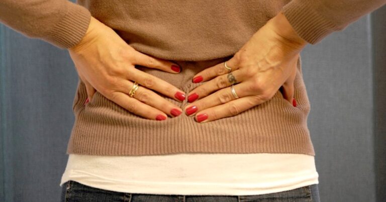 Ilustración médica de la columna vertebral lumbar, mostrando el estrechamiento del canal espinal.