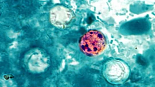 Lechuga iceberg retirada del mercado por brote de ciclosporiasis en Estados Unidos
